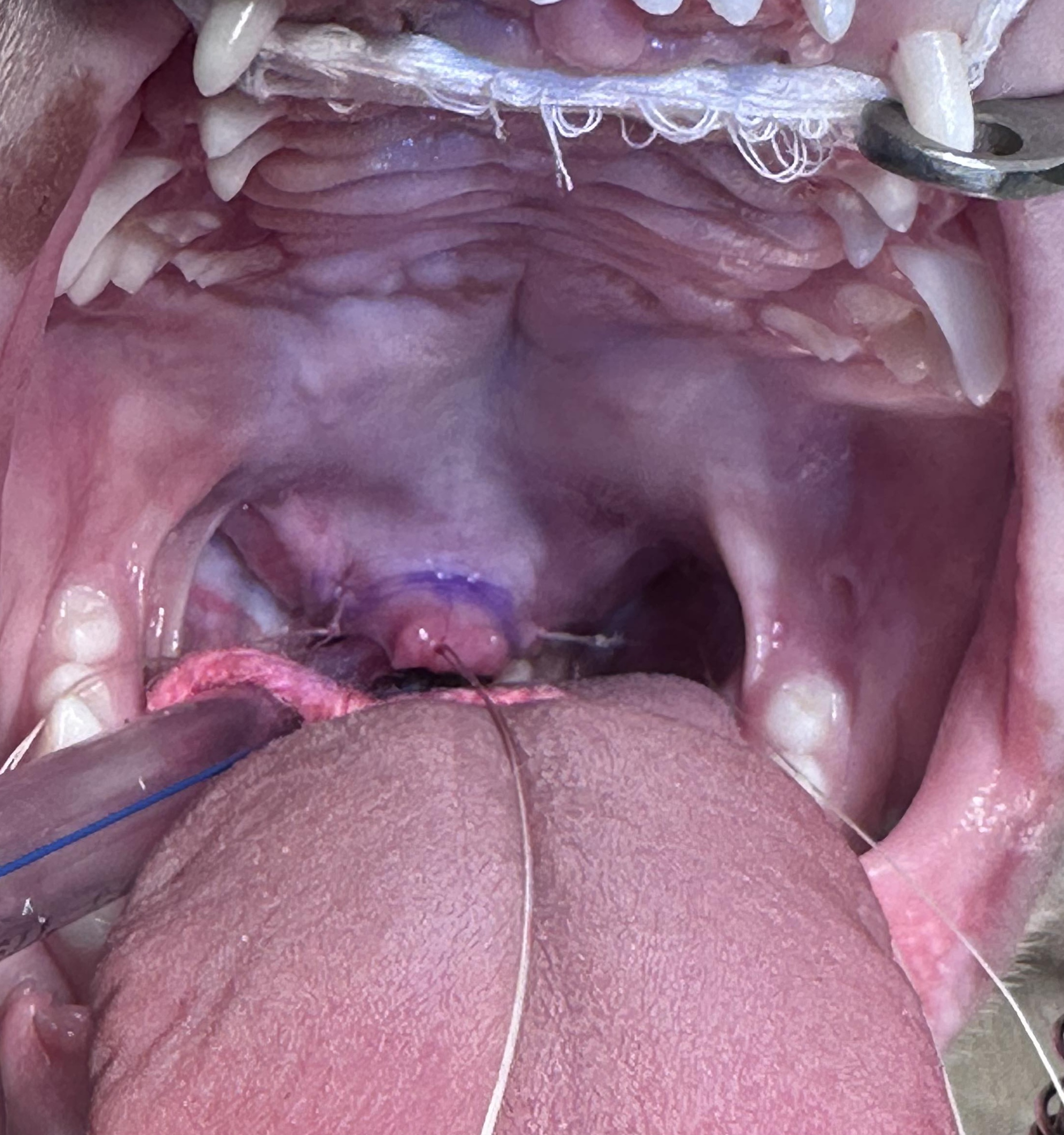 Inside Boston terrier's mouth before elongated soft palate surgery