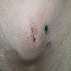 Askley.  Ashley developed swelling after excess activity.