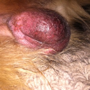 Shadow. Significant swelling and reddness of surgical site due to infection that developed.