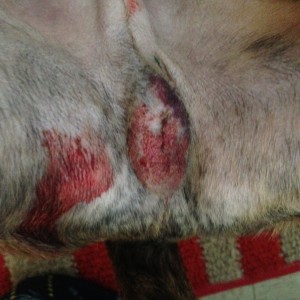 Spike.  Developed bruising and small amount of bloody drainage.