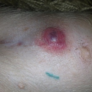 Penny, 2 months after surgery.  An abscess developed and needed lanced and treated.